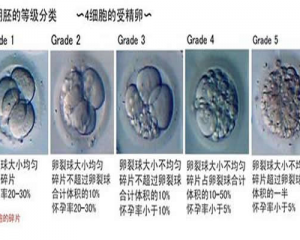 细解试管胚胎等级与成功率的关系及影响试管成功率的因素