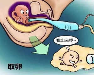 做试管哪个阶段最痛？取卵痛吗？听听过来人怎么说