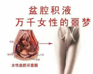 盆腔积液会影响怀孕吗？盆腔积液的6大危害